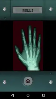 Scanner X-ray screenshot 5