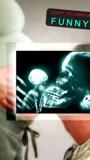 веселые рентгеновские лучи screenshot 3
